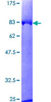 KNG1 (Human) Recombinant Protein (P01)