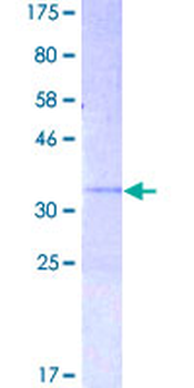 CXCL10 (Human) Recombinant Protein (P01)