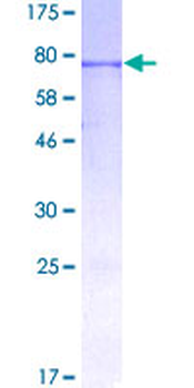 INHBA (Human) Recombinant Protein (P01)