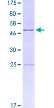 IL18 (Human) Recombinant Protein (P01)