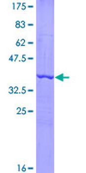 IL17 (Human) Recombinant Protein (Q01)
