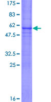 TNFRSF9 (Human) Recombinant Protein (P01)