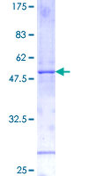 IL11 (Human) Recombinant Protein (P01)