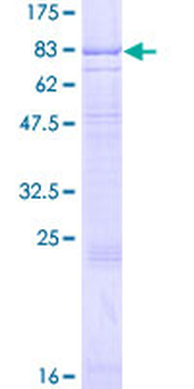IL7R (Human) Recombinant Protein (P01)