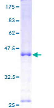 IL7 (Human) Recombinant Protein (P01)