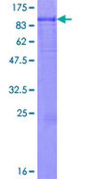IL6R (Human) Recombinant Protein (P01)