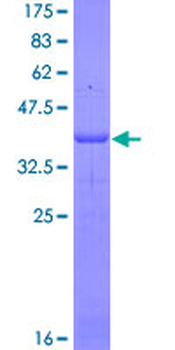 IL4R (Human) Recombinant Protein (Q01)