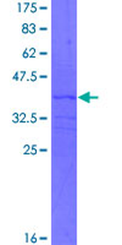 IL4 (Human) Recombinant Protein (Q01)