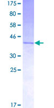IL3 (Human) Recombinant Protein (P02)