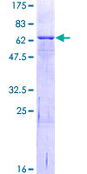 IL1RAP (Human) Recombinant Protein (P01)