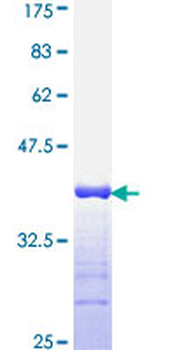 IL1B (Human) Recombinant Protein (Q01)