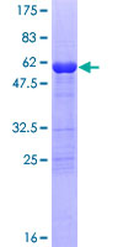 IL1B (Human) Recombinant Protein (P02)