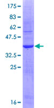 IL1A (Human) Recombinant Protein (Q01)