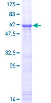 IL1A (Human) Recombinant Protein (P01)