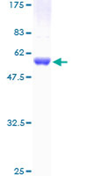 IKBKB (Human) Recombinant Protein (P01)