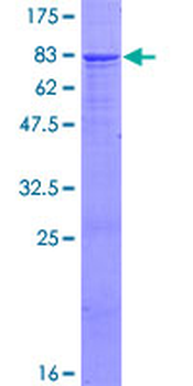 IGHG4 (Human) Recombinant Protein (P01)
