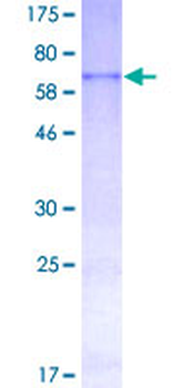 CYR61 (Human) Recombinant Protein (P02)