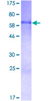 CYR61 (Human) Recombinant Protein (P01)