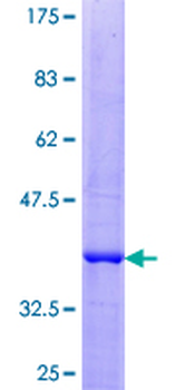 IGF2 (Human) Recombinant Protein (P02)