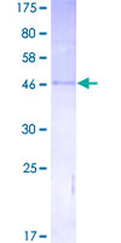 IGF2 (Human) Recombinant Protein (P01)