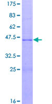 IGF1 (Human) Recombinant Protein (P02)