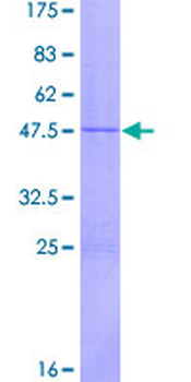 IFNW1 (Human) Recombinant Protein (P01)