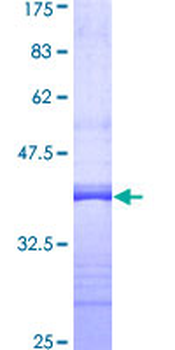 IFNAR1 (Human) Recombinant Protein (Q01)
