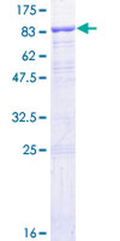 IFNAR1 (Human) Recombinant Protein (P01)