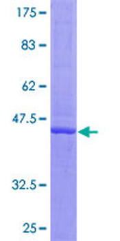 IFNA16 (Human) Recombinant Protein (P01)