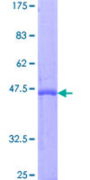 IFNA2 (Human) Recombinant Protein (P01)