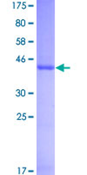 IFNA1 (Human) Recombinant Protein (P01)