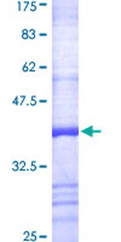IDS (Human) Recombinant Protein (Q01)