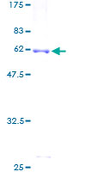 IDS (Human) Recombinant Protein (P01)