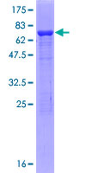 IDH1 (Human) Recombinant Protein (P02)