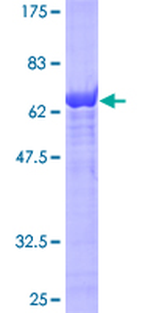 IDH1 (Human) Recombinant Protein (P01)