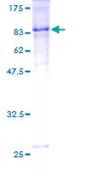 ICAM1 (Human) Recombinant Protein (P01)