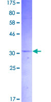 IAPP (Human) Recombinant Protein (P01)