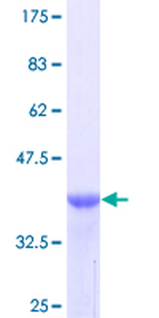 TNC (Human) Recombinant Protein (Q01)