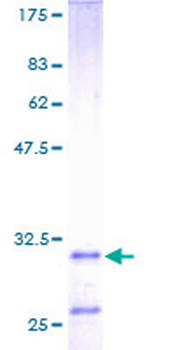 HTN3 (Human) Recombinant Protein (P01)