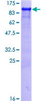 HSP90AB1 (Human) Recombinant Protein (P01)