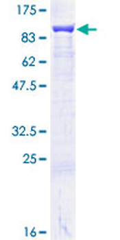 HSPA9 (Human) Recombinant Protein (P01)