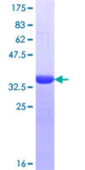 HSPA6 (Human) Recombinant Protein (Q01)