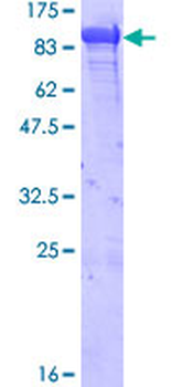 HSPA5 (Human) Recombinant Protein (P01)