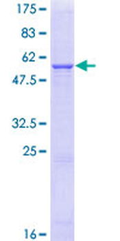 HSD11B1 (Human) Recombinant Protein (P01)