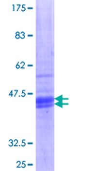 HRH1 (Human) Recombinant Protein (Q01)