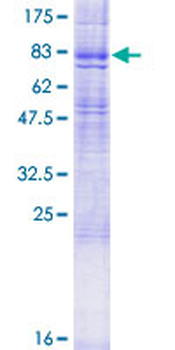 HRH1 (Human) Recombinant Protein (P01)