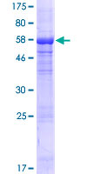 HPS1 (Human) Recombinant Protein (P02)
