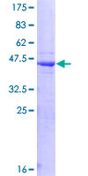 HPS1 (Human) Recombinant Protein (P01)