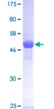 HPRT1 (Human) Recombinant Protein (P01)