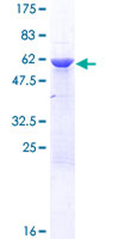 HNRNPC (Human) Recombinant Protein (P01)